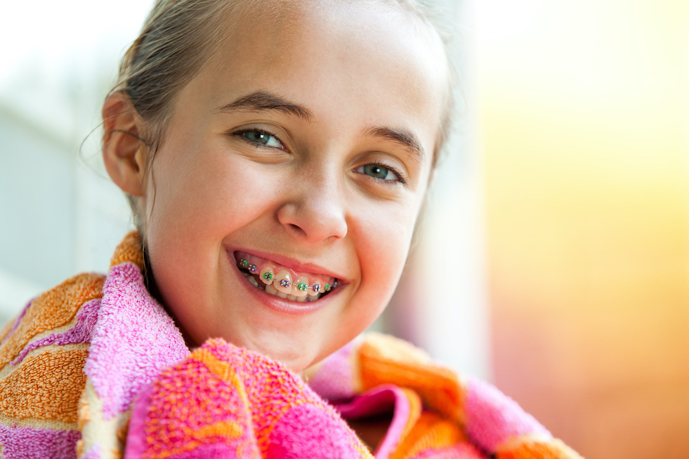 summer girl in braces Should your kid get braces this summer in Charleston SC?