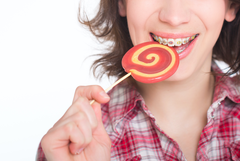 Learn what you shouldn't eat when you have braces in Mount Pleasant SC