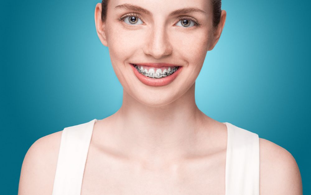 Should I worry about wisdom teeth and braces? Teen with braces