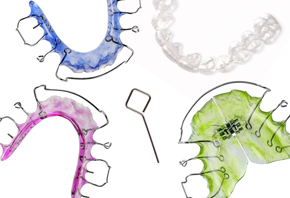 why you might need a retainer instead of braces orthodontist mount pleasant south carolina