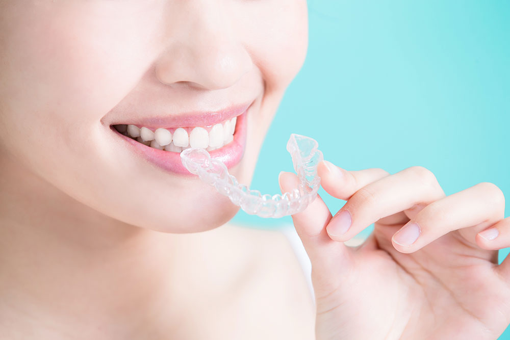 what invisalign is best for me? orthodontist charleston south carolina
