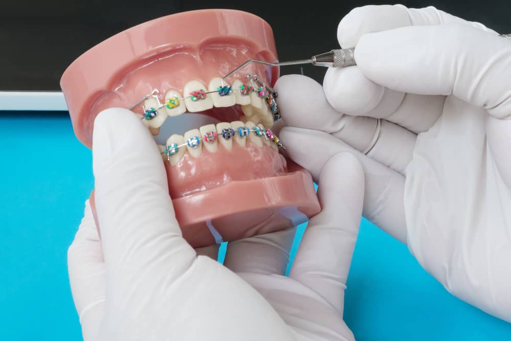 What Is Dentofacial Orthopedics