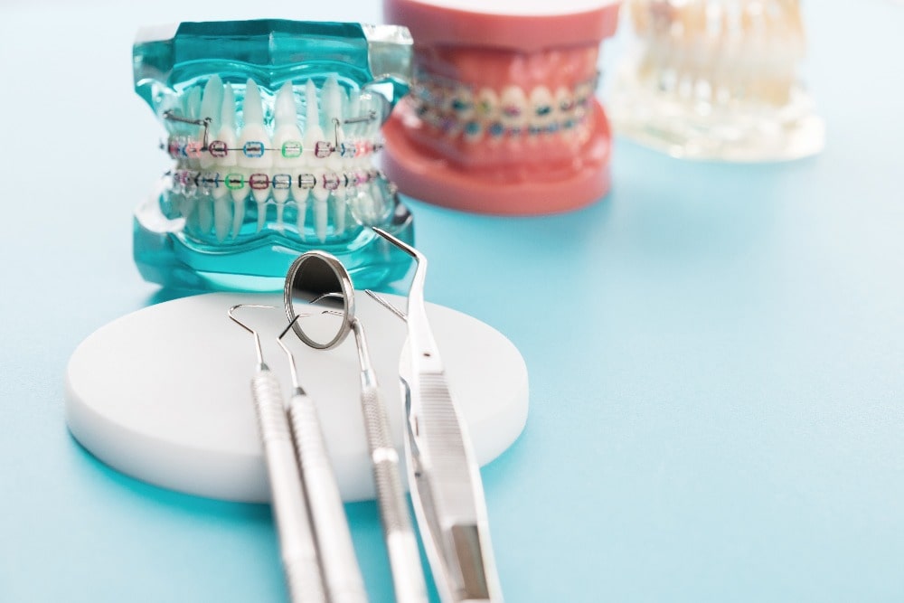 national-orthodontic-health-month orthodontics