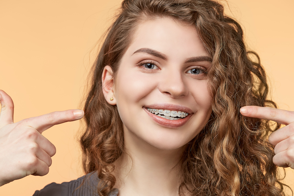 curly hair woman with brackets Learn how to take care of your braces in Charleston SC