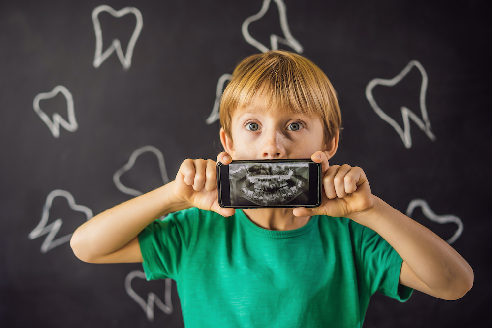 The boy shows his X-ray image of his teeth with an abnormally strange extra tooth. Children's dentistry. Patient Orthodontist Supernumerary teeth in Charleston SC